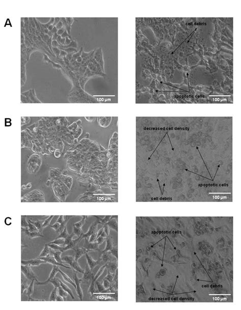Representative microphotographs at a 200 × magnification (20 × ... 