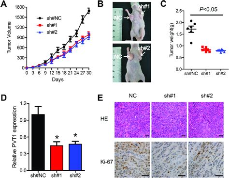 Knockdown Of PVT1 Suppresses ESCC Tumor Growth In Vivo A And B