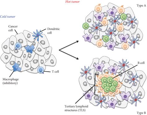 Classification Of Tumors By Immune Cell Infiltration Tumor Types Can