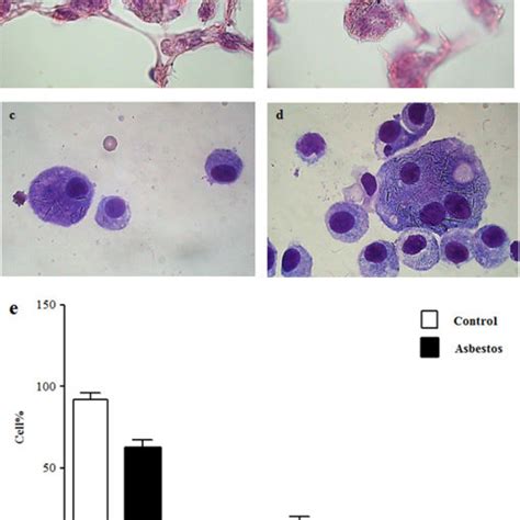 Lung Inflammation And Fibrosis Lung Inflammation Representative Download Scientific Diagram