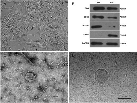 Characterizations Of Hucmscs And Evs A Fibroblast Like Morphology Of