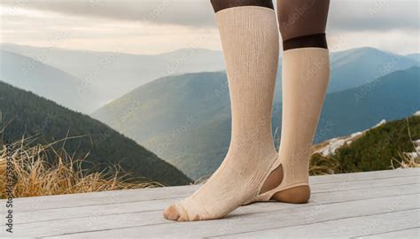 Compression Garments For The Treatment Of Lipoedema And Lymphoedemalymphedema Management