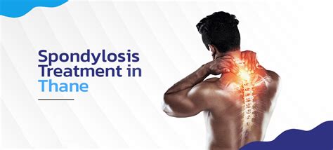 Spondylosis Treatment in Thane - The Spine Clinics