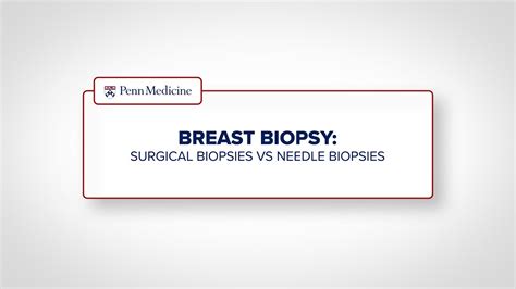 Breast Biopsy Surgical Biopsy Vs Needle Biopsy Youtube