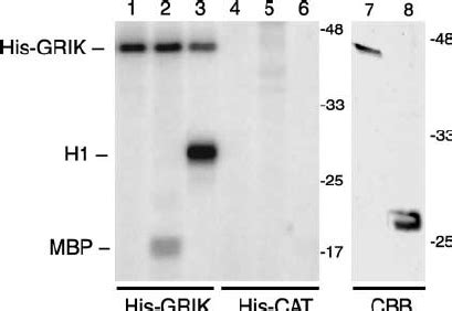 GRIK Acts as a Protein Kinase in Vitro. | Download Scientific Diagram