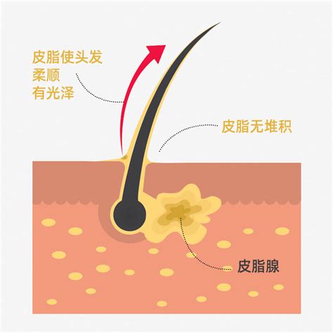 刘长春的诊间日记：聊聊头皮出油的那些事（一） 刘长春 爱问医生