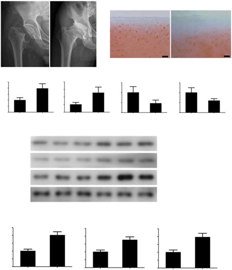 P Creb Mmp Is Active In Human Osteoarthritic Chondrocytes A