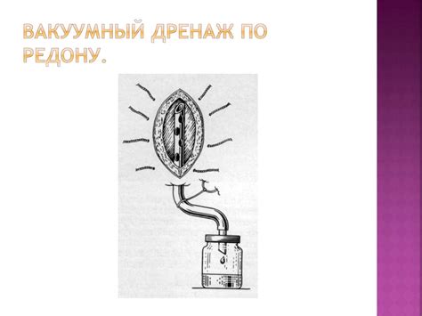 Раны. Классимфикации - презентация онлайн