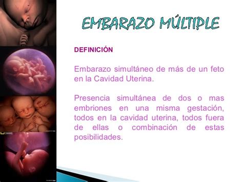 Embarazo Multiple