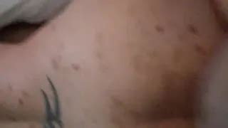 Cellulite Porn Videos Flabby Fat Asses Xhamster