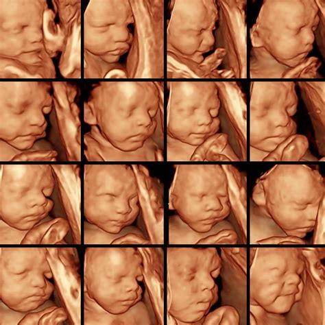 30 Weeks Pregnant 4d Ultrasound 30 Weeks Pregnant 4d Ultrasound