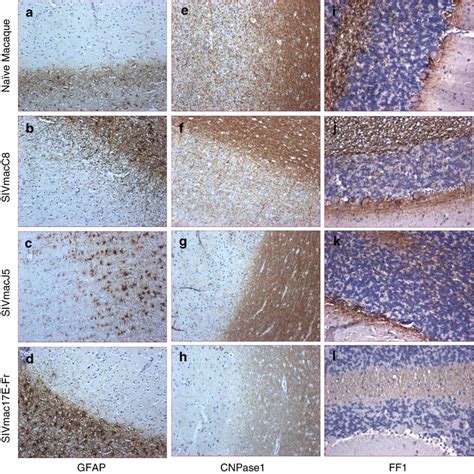 Representative Images Showing Immunohistochemical Staining Results For Download Scientific