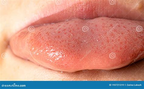 Macro Photo Of Healthy Human Language Tongue Papillae Taste Buds And