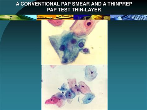 Trends In Development Of Cytopathology Ppt Download