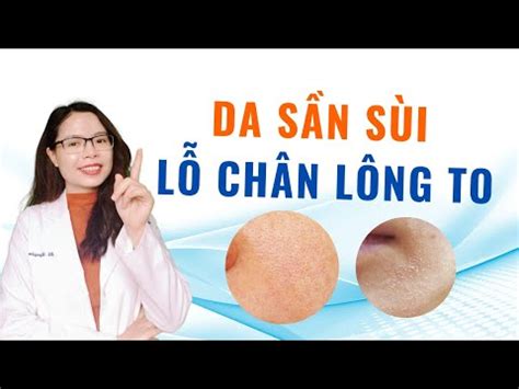 Da Mặt Bị Sần Sùi Không Mịn Khắc Phục Da Sần Sùi Thâm Sạm Tại Nhà