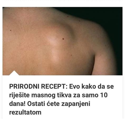 Prirodni Recept Za Uklanjanje Masnog Tkiva Ukusna Hrana