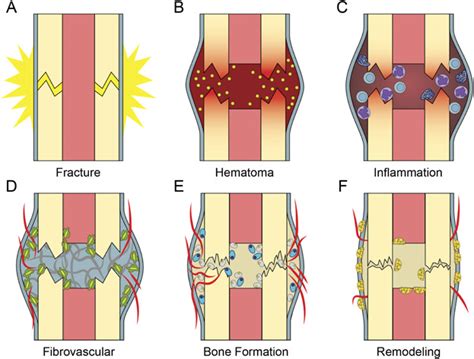 Cellular Biology Of Fracture Healing Bahney 2019 Journal Of