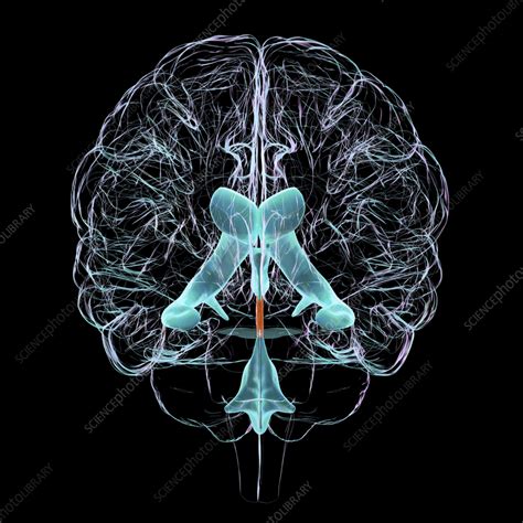 Cerebral Aqueduct Illustration Stock Image F040 4184 Science