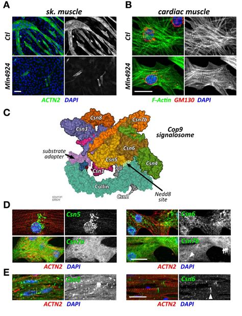 Figure From The Role Of Cullin Ring Ligases In Striated Muscle