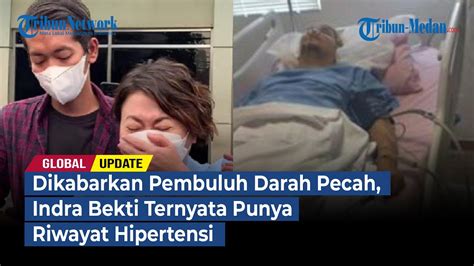 Dikabarkan Pembuluh Darah Pecah Indra Bekti Ternyata Punya Riwayat