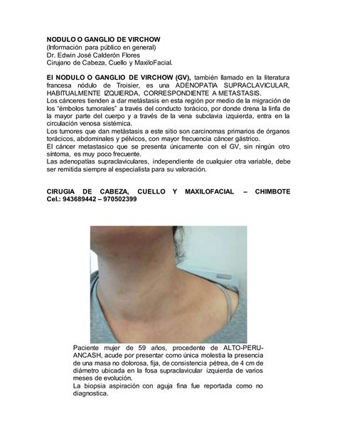 Ganglio De Virchow