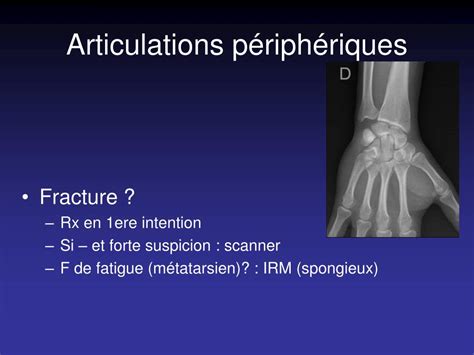 Ppt Principes De Radio Anatomie En Osteo Articulaire Powerpoint