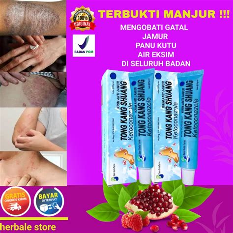 Jual Obat Kulit Gatal Paling Ampuh Jamur Eksim Kurap Kudis Obat Gatal