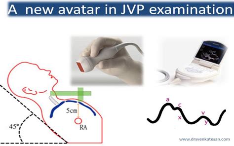 jugular venous pressure | Dr.S.Venkatesan MD