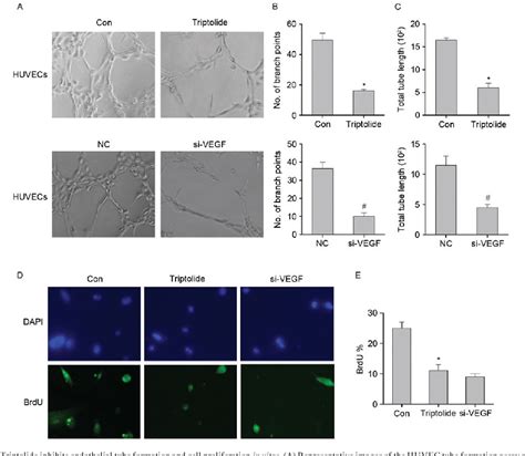 Figure From Triptolide Inhibits Vascular Endothelial Growth Factor