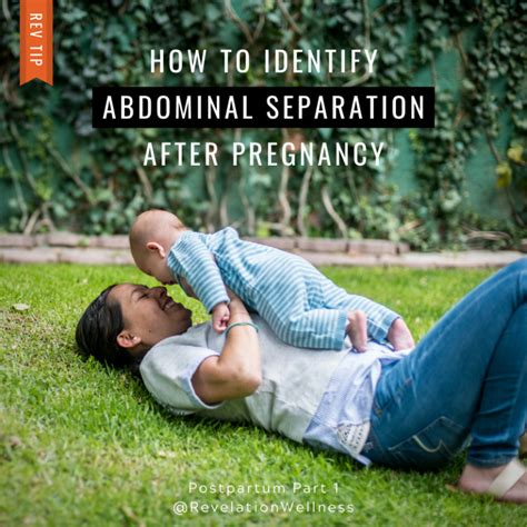 Postpartum Health Pt1 Identifying Abdominal Separation Revelation