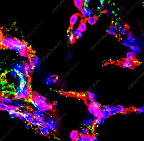 Lung Alveoli Fluorescence Micrograph Stock Image C038 3107