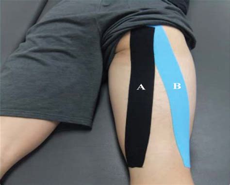 Effect Of Balance Taping Using Kinesiology Tape For A Hamstr Medicine