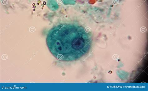 Entamoeba Histolytica Infective Cyst On Trichrome Stain Stock Image Image Of Medicine