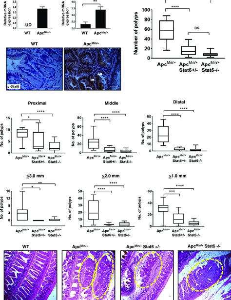 Deficiency Of Stat6 Reduces Intestinal Polyps In ApcMin Mice A