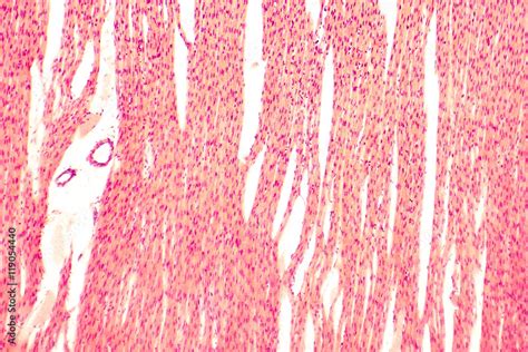 Heart Muscle Light Micrograph Striated Cardiac Muscle Cells Myocytes