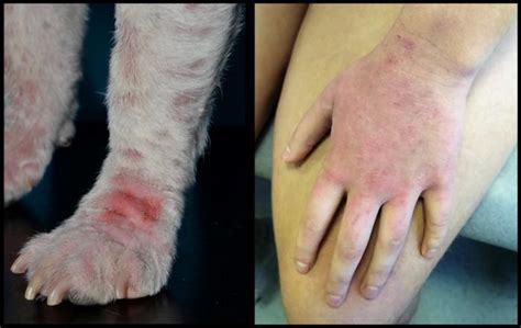 Dermatitis At Pica En Personas Y En Perros Se Trata De La Misma