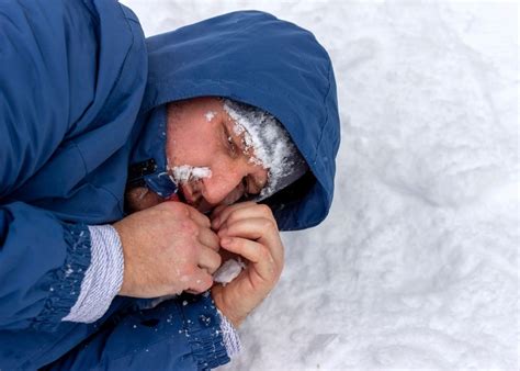 Hypothermia And Cold Related Injuries