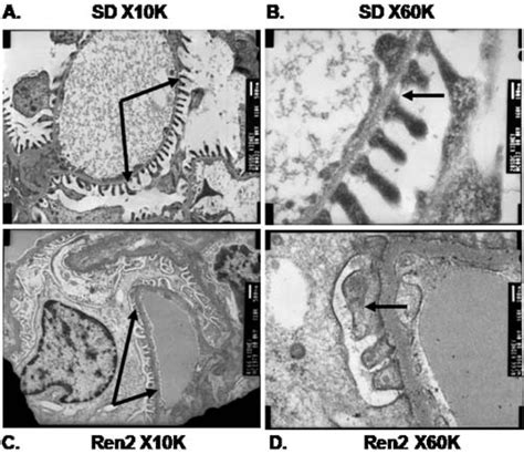 Ultrastructural Structural Depiction Of Podocyte Foot Processes In The