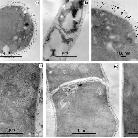 Transmission Electron Micrographs Of Beauveria Bassiana Showing The Download Scientific Diagram