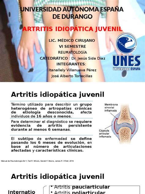 Artritis Idiopatica Juvenil Artritis Especialidades Medicas