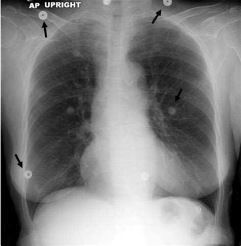 Radiology Exam Flashcards Quizlet