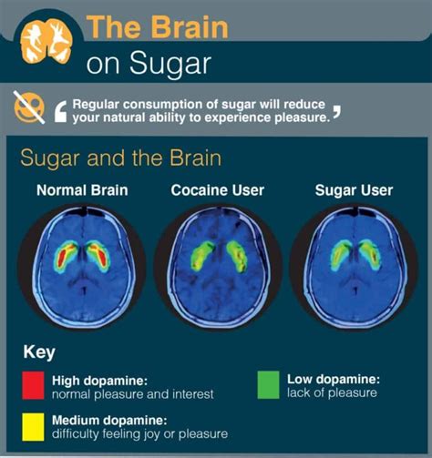 Your Brain On Sugar What The Science Says Dietcommunity