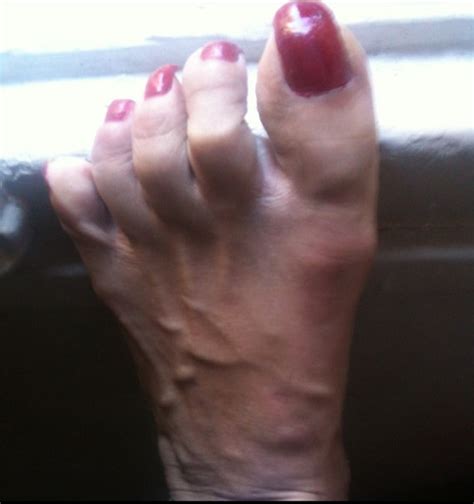 Red Toenails Mix Older Dirty Toe Ring Sandals Mixed Porn Pictures XXX Photos Sex Images