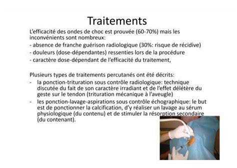 Traitements Lefficacit