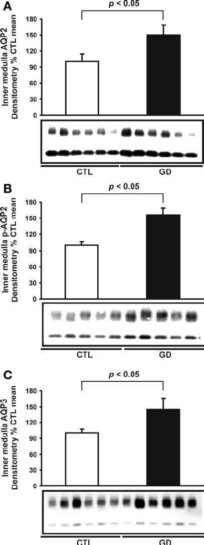 Semiquantitative Immunoblots Of Aquaporins AQPs From Kidney Proteins