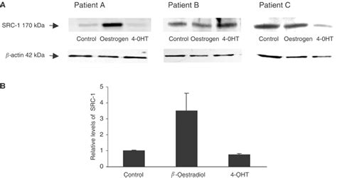 Western Blot Analysis Of Src 1 Protein Levels In Primary Breast Download Scientific Diagram