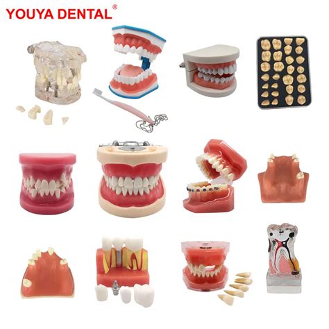 Diff Rents Mod Les Dentaires Mod Le D Enseignement Tude Implant