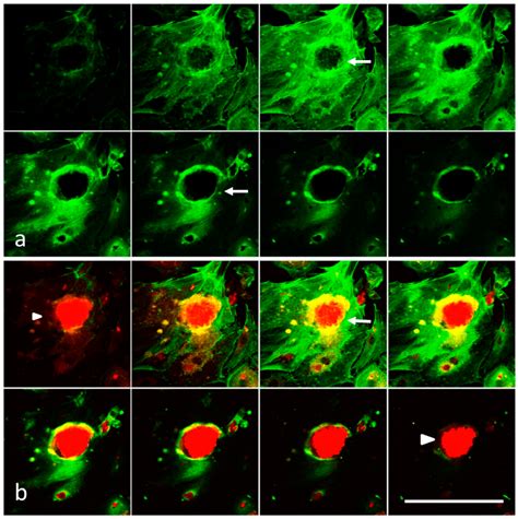 Laser Scanning Confocal Microscopy Serial Optical Sections From The