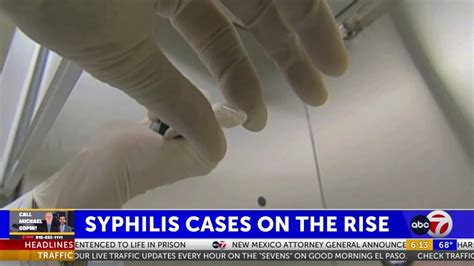 Us Syphilis Cases Are Rising And Std Clinics Warn Theyre Struggling