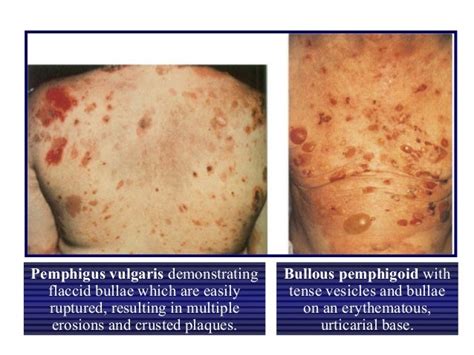 Dermatology Approach